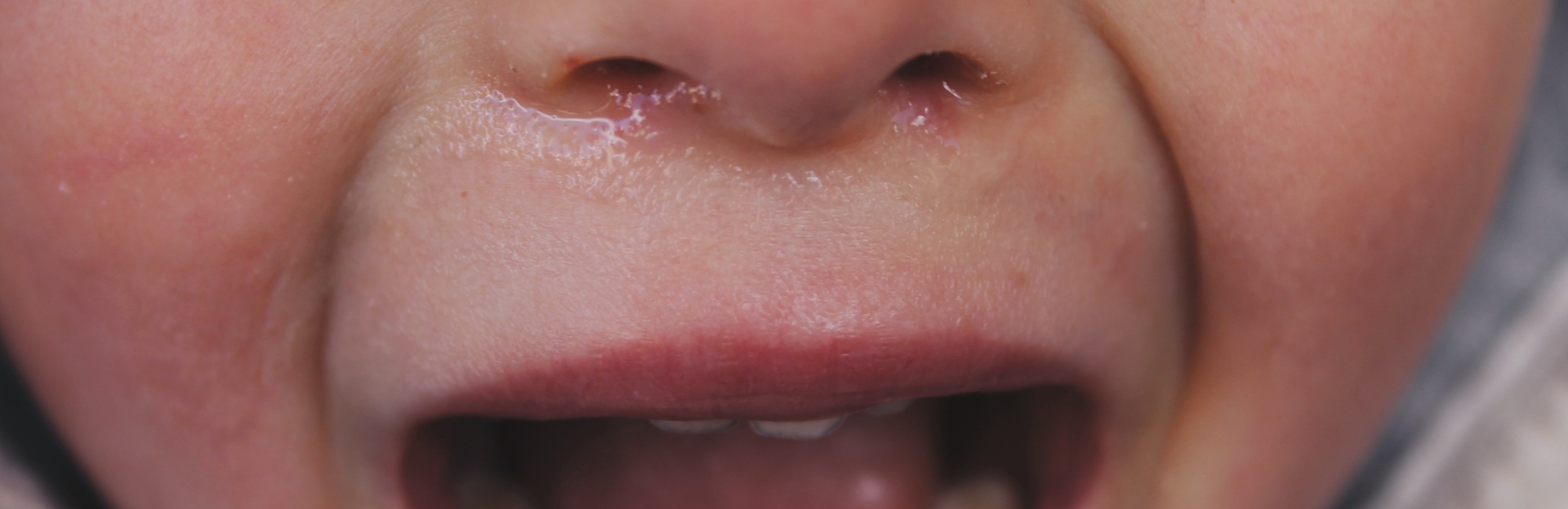 close up of crying toddler's nose and mouth