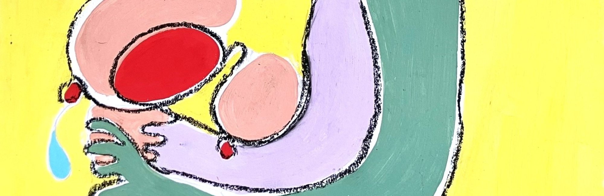 breast lump; breast abscess; lactation; breastfeeding